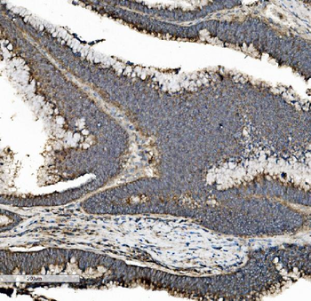 Anti-Prohibitin/PHB Antibody