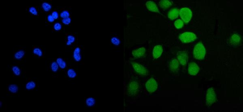 Anti-PLTP Antibody