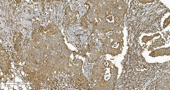 Anti-PLTP Antibody