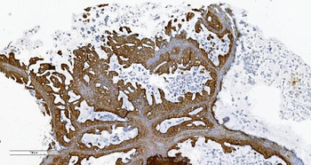 Anti-PLTP Antibody