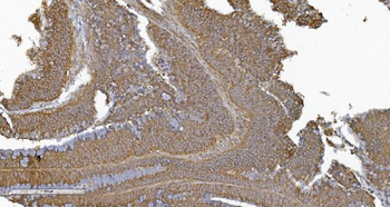 Anti-PLTP Antibody