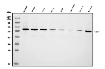 Anti-PLTP Antibody