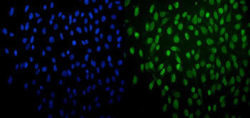 Anti-PRDM14 Antibody