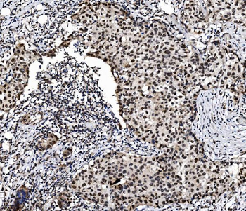 Anti-PRDM14 Antibody