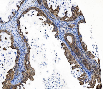 Anti-PRDM14 Antibody