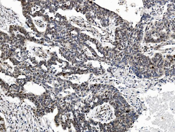 Anti-PRDM14 Antibody