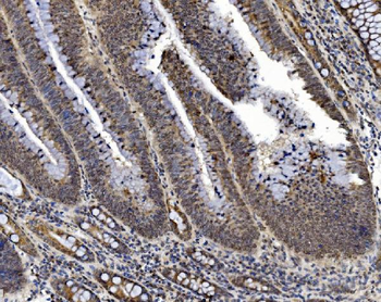 Anti-PRDM14 Antibody