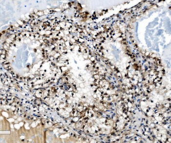 Anti-PRDM14 Antibody