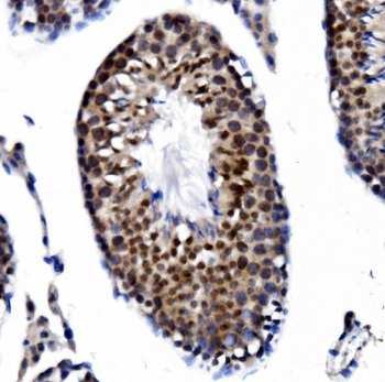 Anti-PRDM14 Antibody