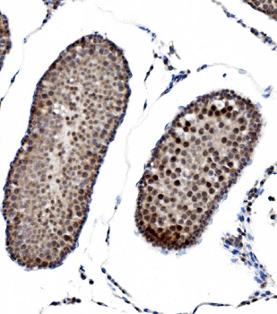 Anti-PRDM14 Antibody