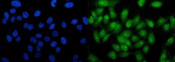 Anti-RTCD1/RTCA Antibody