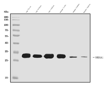 Anti-SRD5A1 Antibody