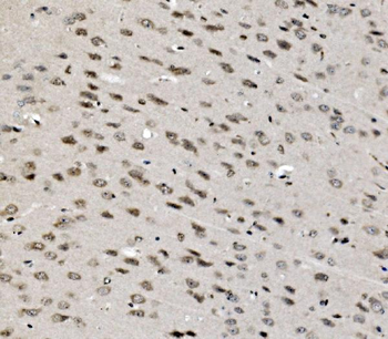 Anti-TAF4 Antibody