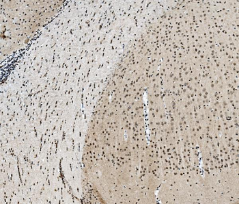 Anti-TAF4 Antibody