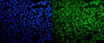 Anti-TAF4 Antibody