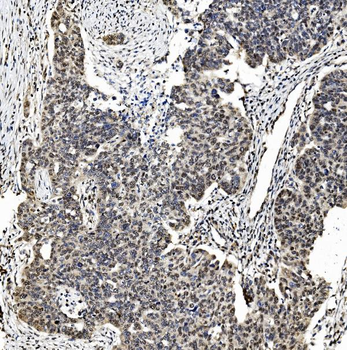 Anti-TAF4 Antibody