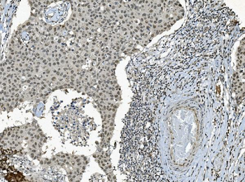 Anti-TAF4 Antibody