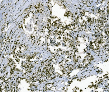 Anti-TAF4 Antibody