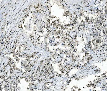 Anti-TAF4 Antibody