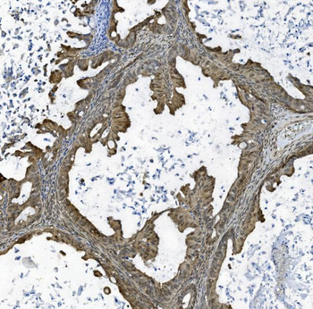 Anti-TAF4 Antibody