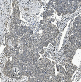 Anti-TAF4 Antibody