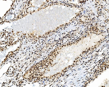 Anti-TAF4 Antibody