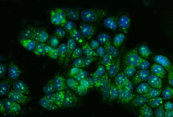 Anti-TBX4 Antibody