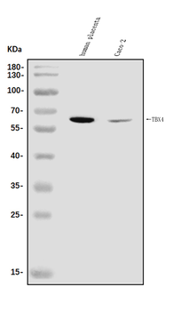 Anti-TBX4 Antibody
