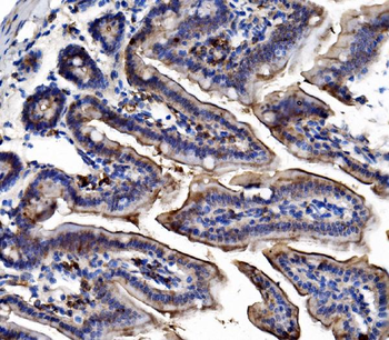 Anti-TRIM16 Antibody