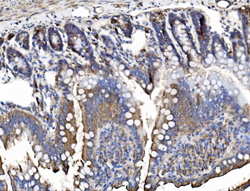 Anti-TRIM16 Antibody