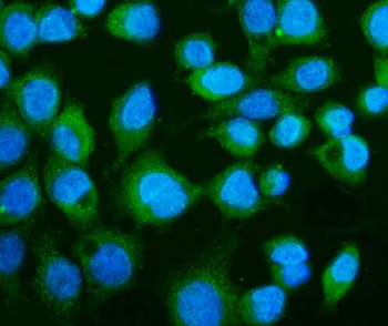 Anti-CGAS Antibody