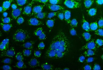 Anti-CHCHD10 Antibody