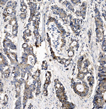 Anti-CHCHD10 Antibody