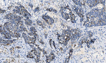 Anti-CHCHD10 Antibody