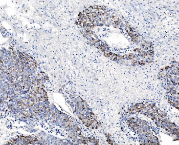 Anti-CHCHD10 Antibody