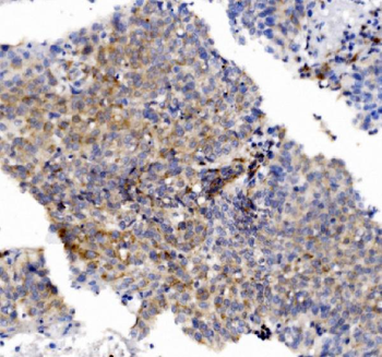 Anti-CHCHD10 Antibody