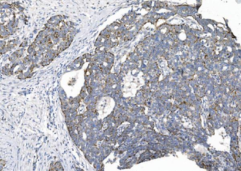 Anti-CHCHD10 Antibody