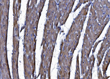 Anti-CHCHD10 Antibody