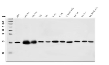 Anti-CHCHD10 Antibody