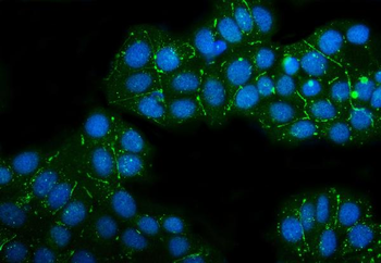 Anti-Claudin 3/CLDN3 Antibody