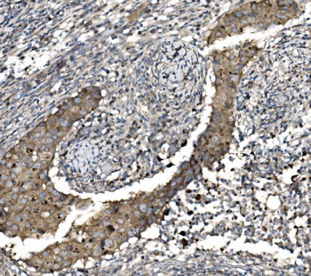 Anti-Claudin 3/CLDN3 Antibody