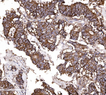 Anti-Claudin 3/CLDN3 Antibody
