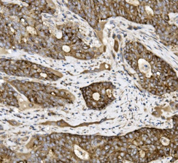 Anti-Claudin 3/CLDN3 Antibody