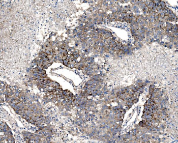 Anti-Claudin 3/CLDN3 Antibody