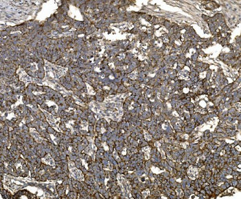 Anti-Claudin 3/CLDN3 Antibody