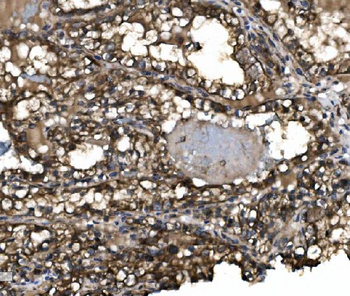 Anti-Claudin 3/CLDN3 Antibody