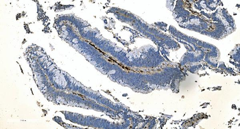 Anti-Coronin 1a/TACO/CORO1A Antibody