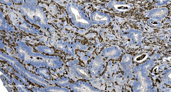 Anti-Coronin 1a/TACO/CORO1A Antibody