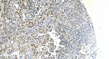 Anti-Coronin 1a/TACO/CORO1A Antibody