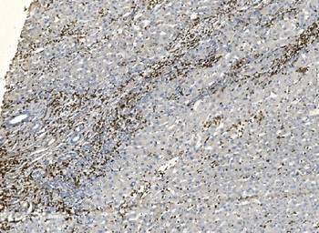 Anti-Coronin 1a/TACO/CORO1A Antibody